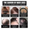 OUHOE Collagen B7 Vitamin Hair Care Essential Oil Nourishes Hair Gently And Softens Hair