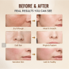 Bee Venom Skin Repair Cream, Gentle Daily Moisturizing & Nourishing Face Cream for All Skin Types